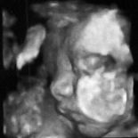 I Was Wrong! Confessions of an Ultrasound Junkie